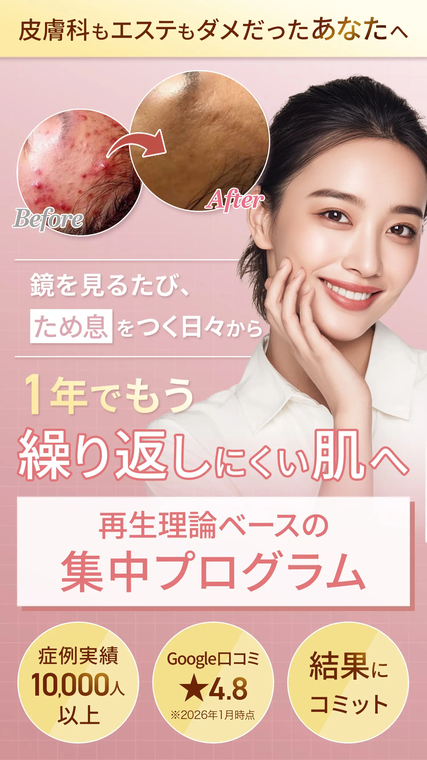 【美容皮膚専科 LA NATURE】皮膚科もエステもダメだったあなたへ｜鏡を見るたびため息をつく日々から1年でもう繰り返しにくい肌へ「再生理論ベースの集中プログラム」