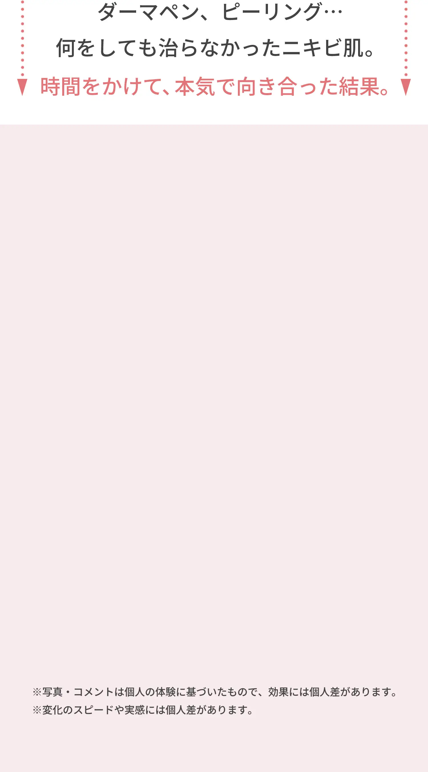 何をしても治らなかったニキビ肌。時間をかけて本気で向き合った結果……